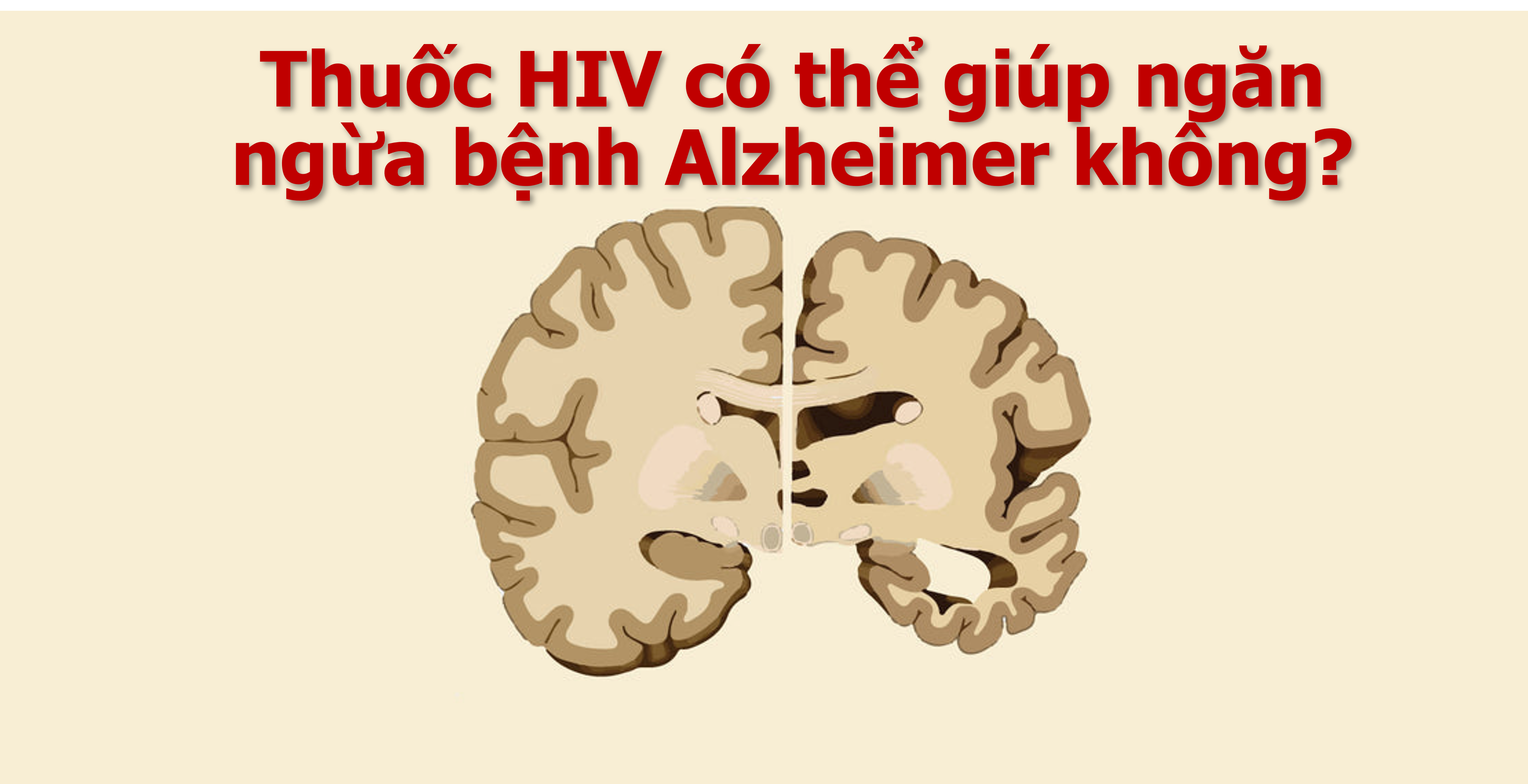 Thuốc Điều Trị Hiv Có Thể Giúp Ngăn Ngừa Alzheimer?